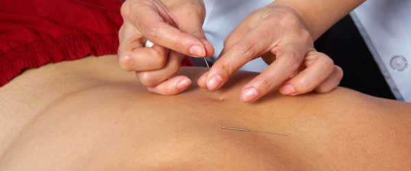 PJP blog - acupuncture help sciatica